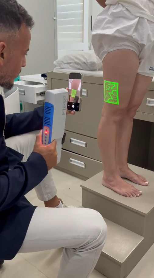 Varizes e estética: até onde é vaidade equando começa o problema de saúde?